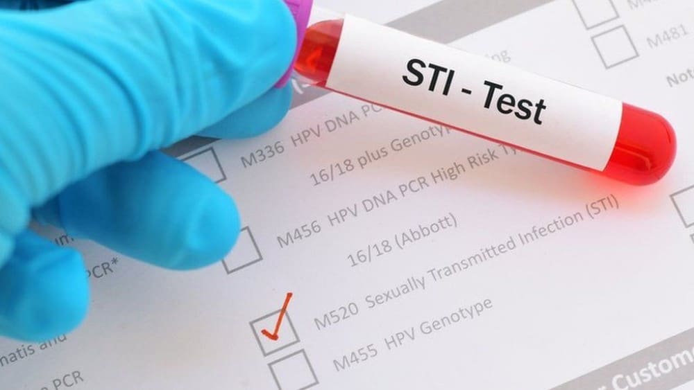 Getting Tested for Sexual Health
